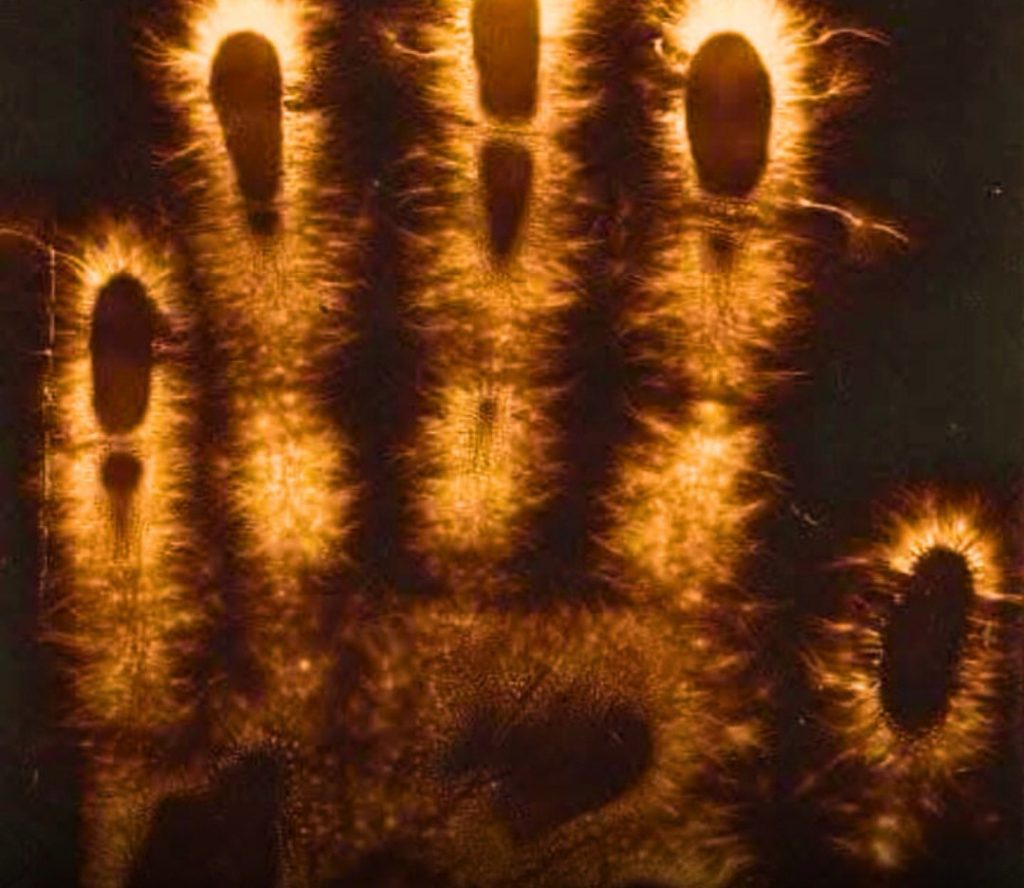 The Hidden Light in Your Hands That Shouldn’t Be Dimmed – BLOG